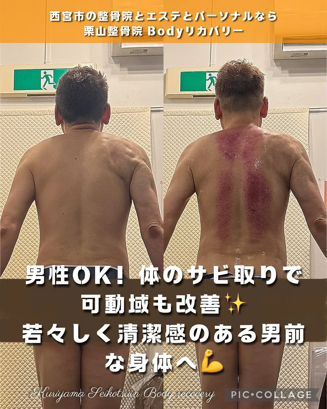 男性ももちろんOK！セルライトゼロ2で誰にでも年齢分蓄積して...