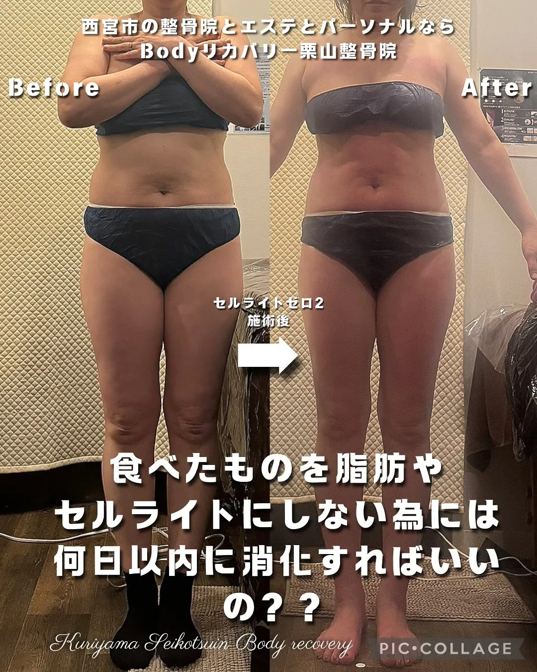 食べたものを脂肪やセルライトにしない為には何日以内に消化すればいいの？？