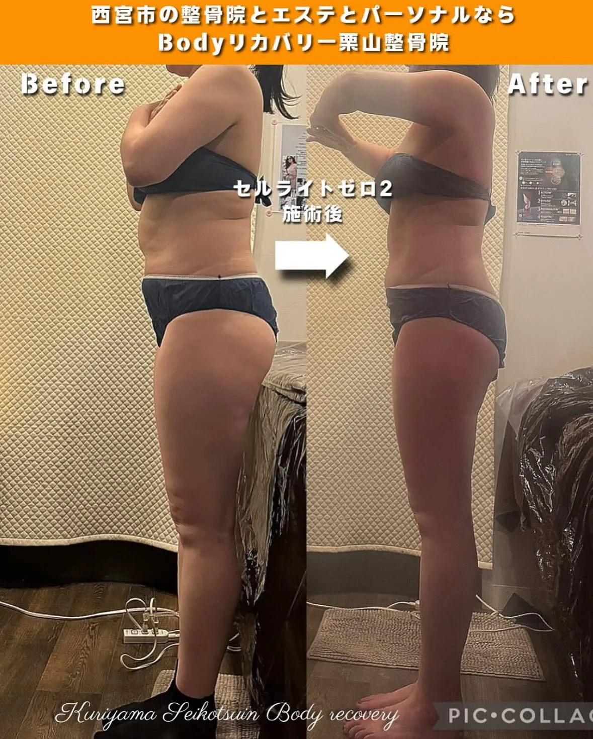 食べたものを脂肪やセルライトにしない為には何日以内に消化すれ...