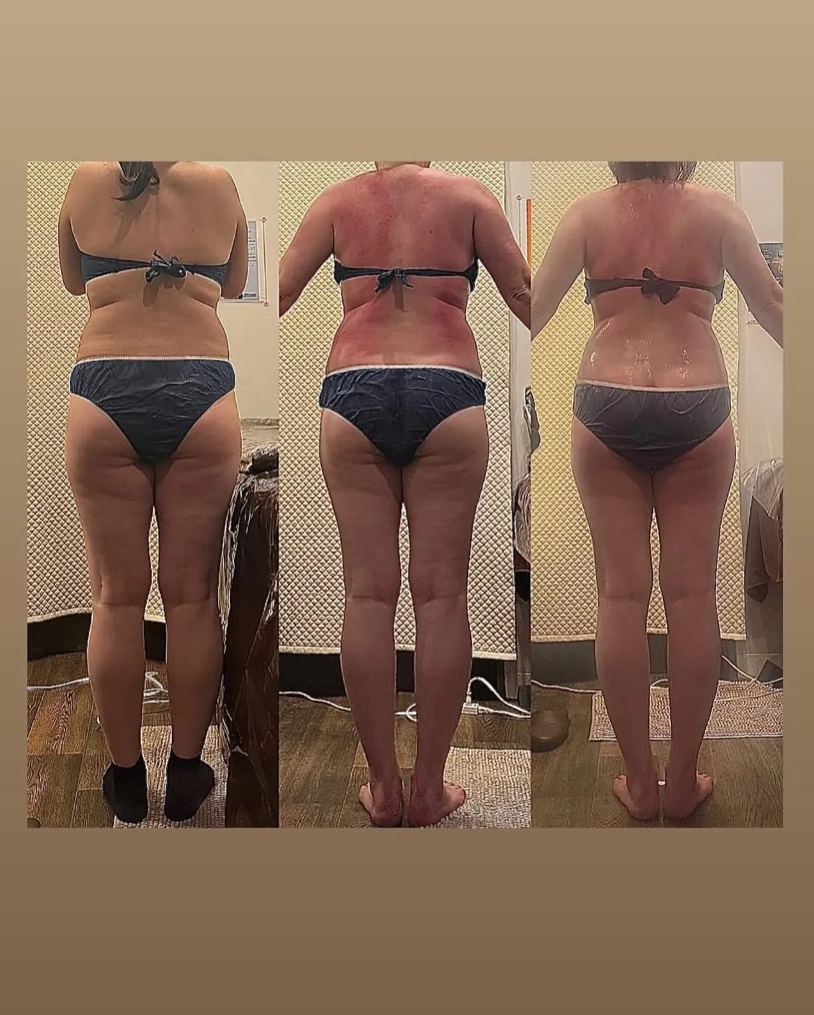 食べたものを脂肪やセルライトにしない為には何日以内に消化すれ...